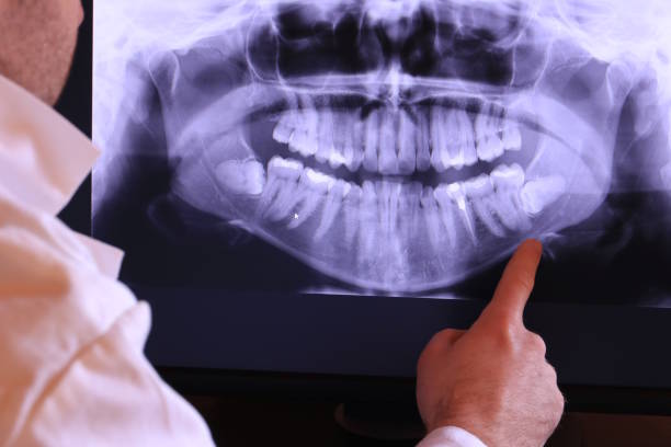 Best Knocked-Out Tooth Emergency  in Syracuse, KS